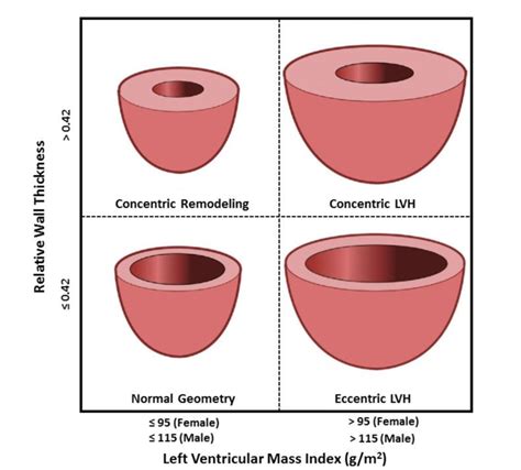 relative wall thickness echo calculator.